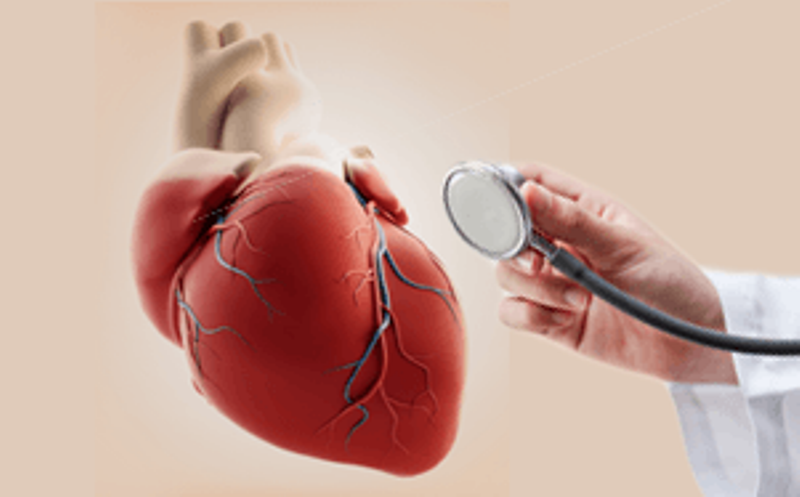Cardiac Screening (Heart Check)